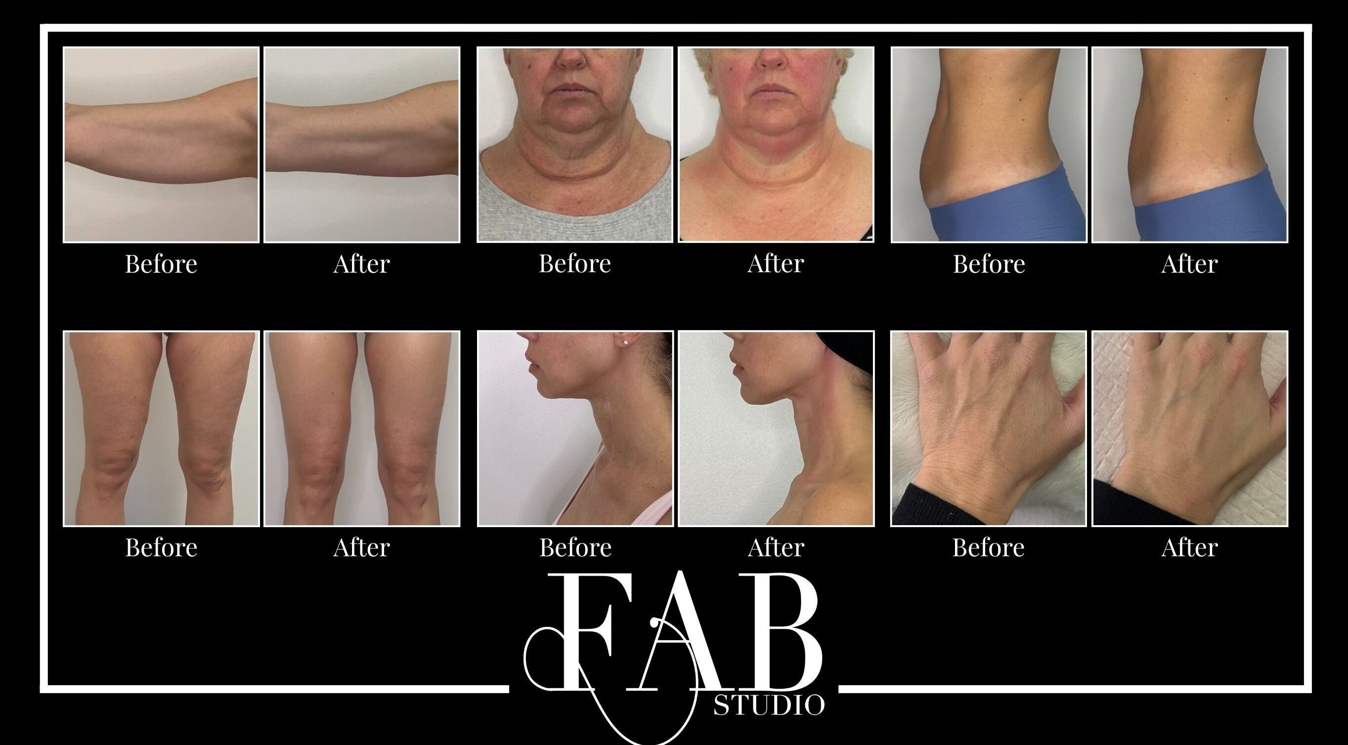 Before and after transformation results at FAB Studio, Neerabup, Western Australia, AU.