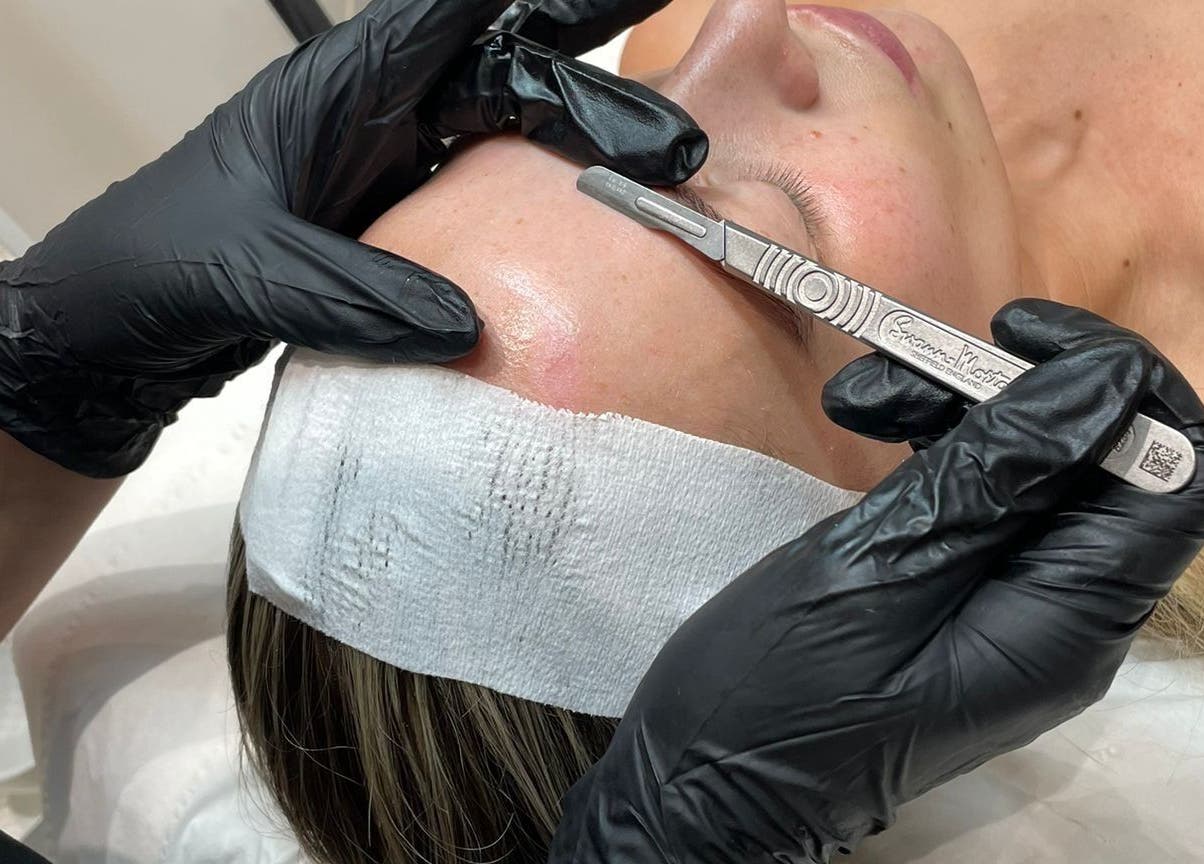 Dermaplane treatment at Nu Glow by Teri, Worsley, England, GB enhancing skin brightness.