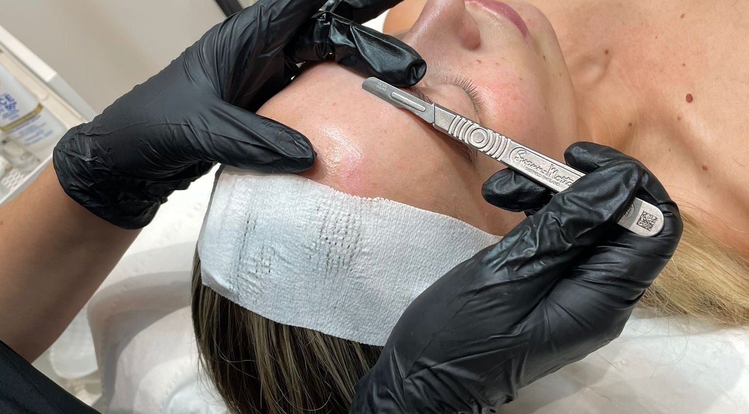 Dermaplane treatment at Nu Glow by Teri, Worsley, England, GB enhancing skin brightness.