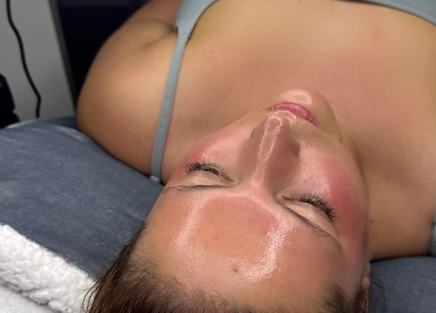 Face treatment at Nu Glow by Teri, Worsley, England. Glowing, rejuvenated skin post-therapy.