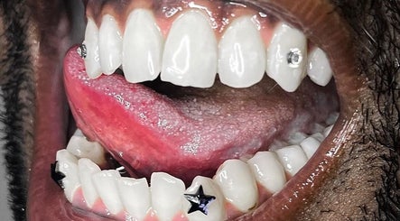 Grin Tooth Gems and Whitening image 2