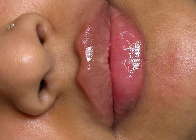Glossy lips at The Needle Room, London, England, GB showcasing beauty enhancement services.