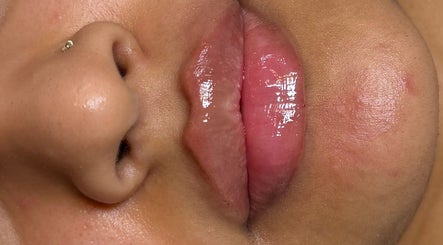 Glossy lips at The Needle Room, London, England, GB showcasing beauty enhancement services.