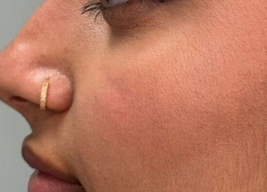 Close-up shot of a nose piercing at The Needle Room in London, England, GB.
