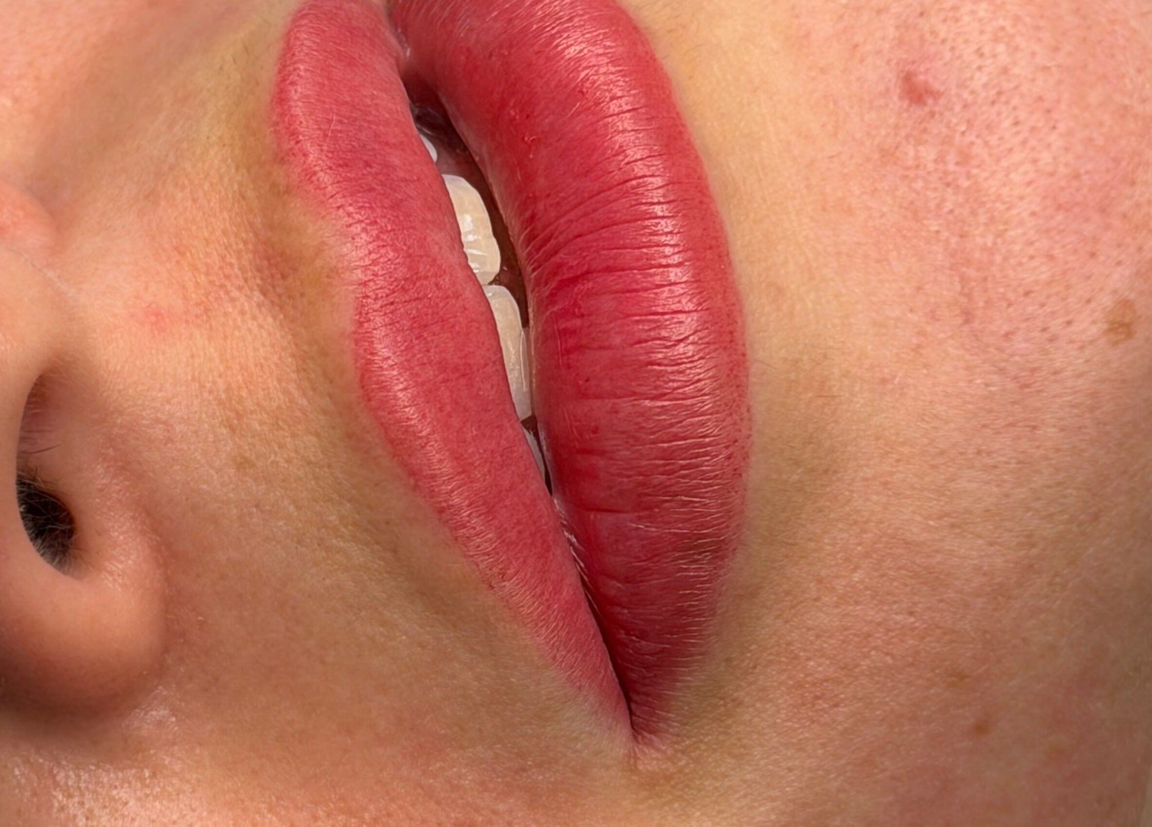 Close-up of vibrant lips treated at Athenas Aesthetics, Hollywood, Florida, US.