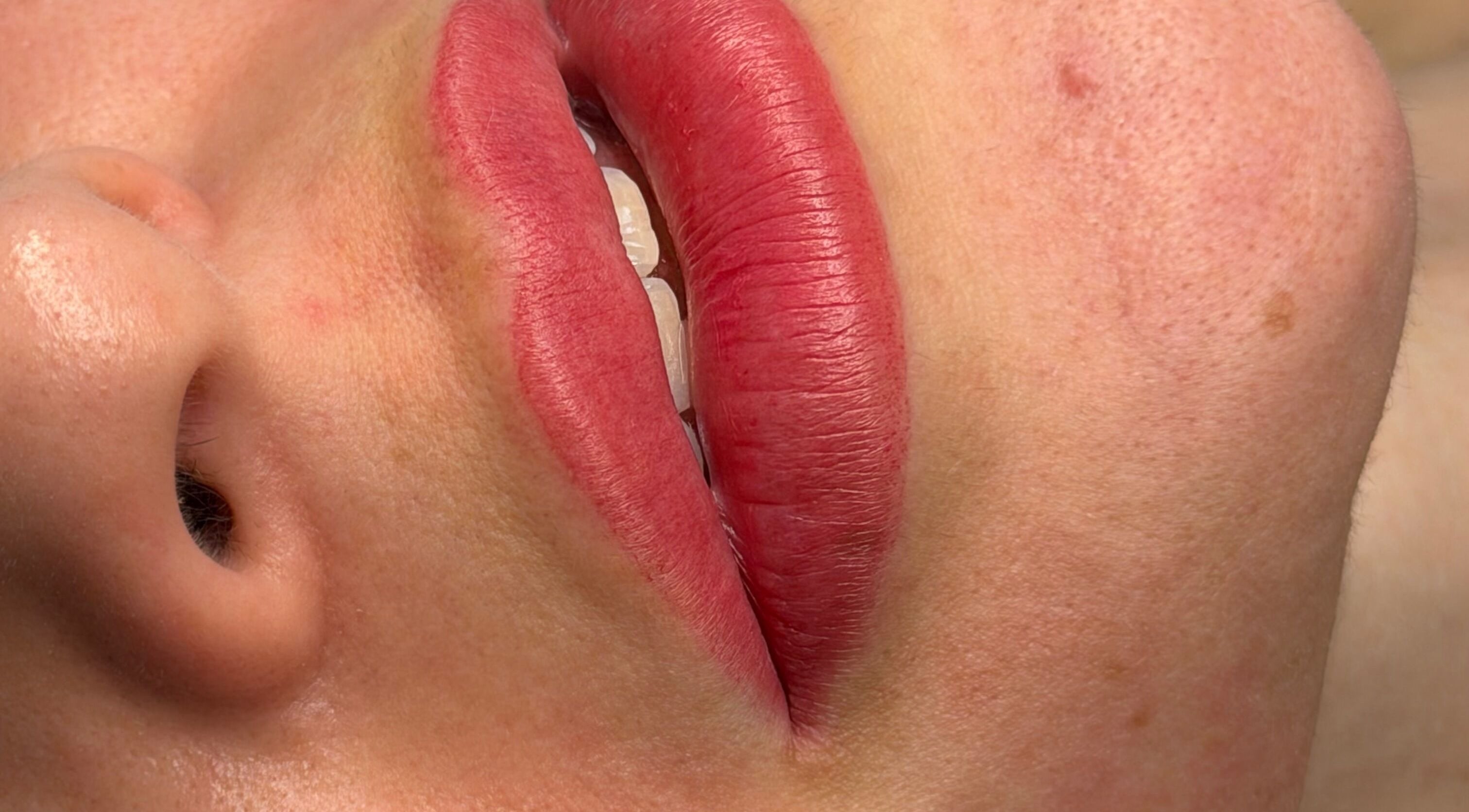 Close-up of vibrant lips treated at Athenas Aesthetics, Hollywood, Florida, US.