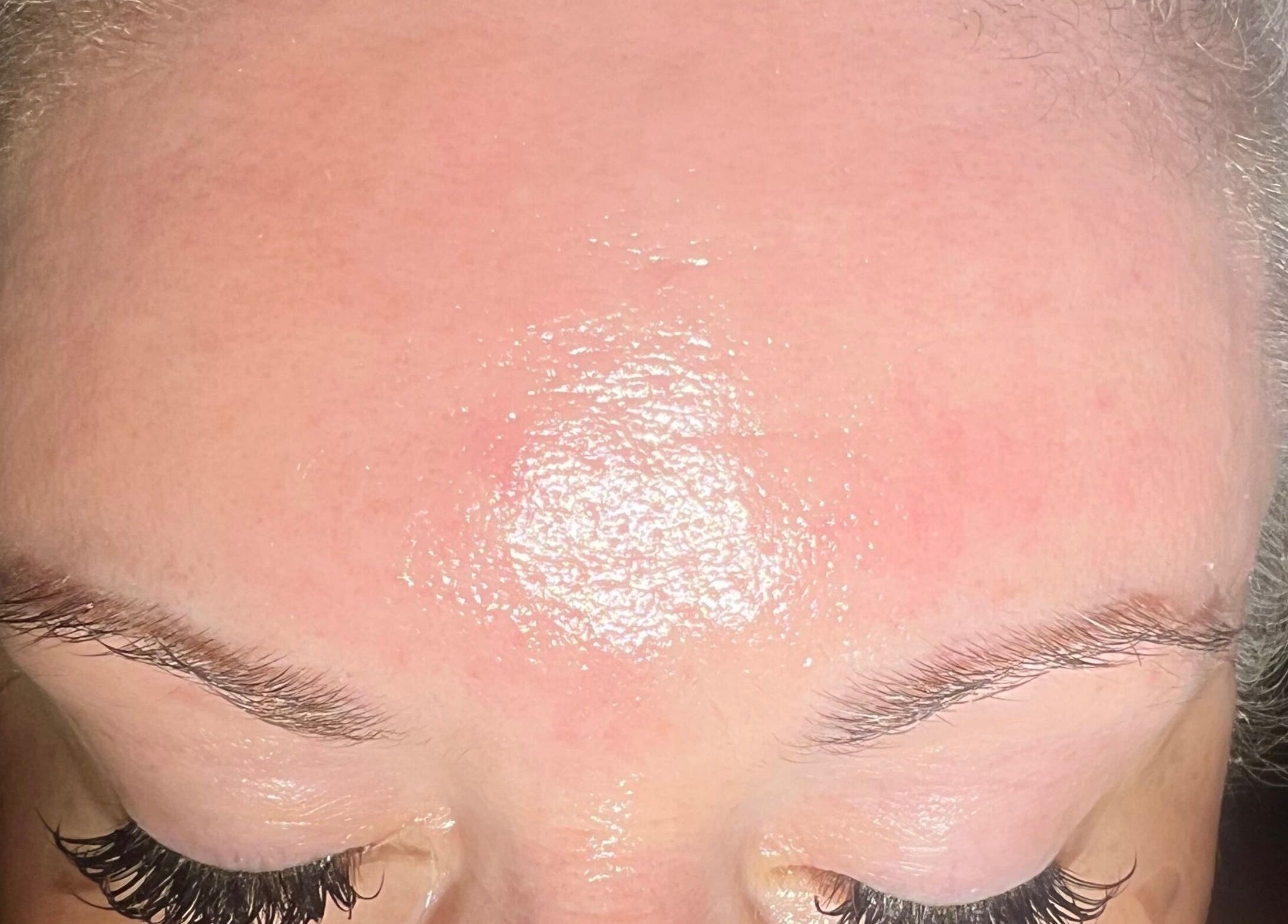 Glowing skin treatment at GlowLyssa Esthetics, Ada, Oklahoma, US, for a flawless complexion.