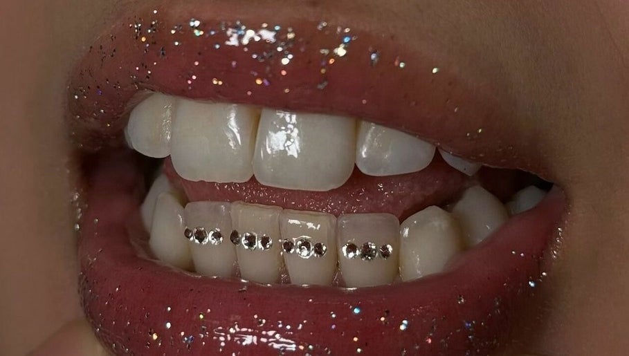 Immagine 1, Glisten Up