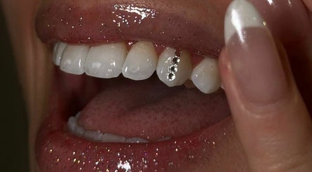 Immagine 3, Glisten Up