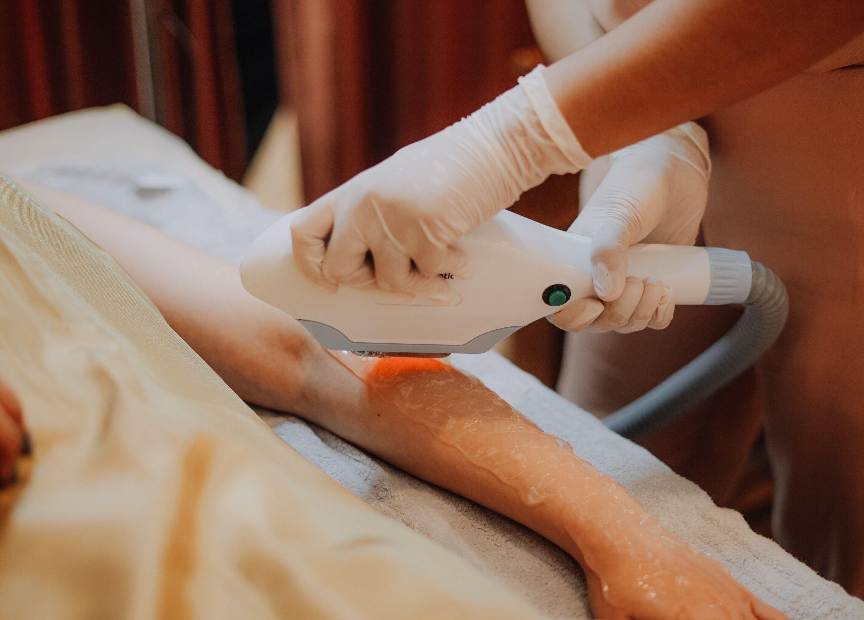 Laser hair removal at Glow In Beauty Studio in Bali, Bali, ID, offering smooth, radiant skin services.