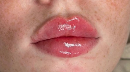 EBL Aesthetics Clinic image 2