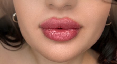 Filler, Botox, and PRP by Nurse Jearish kép 2