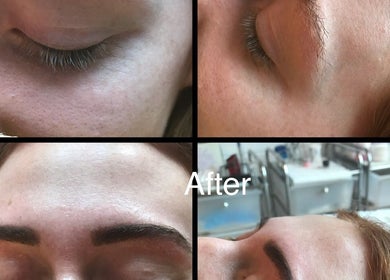 Before and after eyebrow treatment at Unique beauty & aesthetics, Rhosllanerchrugog, Wales, GB.