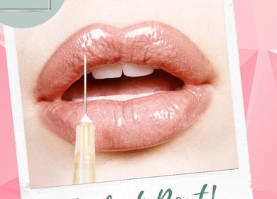 Glossed lips with syringe at Unique Beauty & Aesthetics, Rhosllanerchrugog, Wales, GB offering beauty treatments.