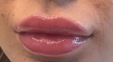 Glossy lips at Unique Beauty & Aesthetics, Rhosllanerchrugog, Wales, GB. Perfect for enhancing natural beauty.