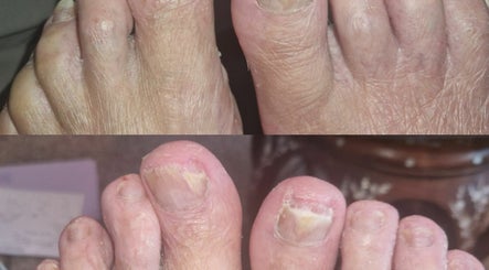 GP foot health image 3