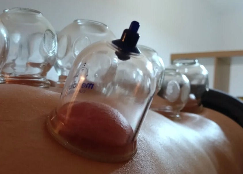 Cupping therapy session at Spiritual Wellness Retreat, Νέα Μάκρη, Μαραθώνος, GR, rejuvenating mind and body.