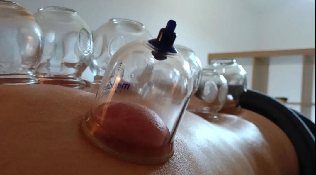 Cupping therapy session at Spiritual Wellness Retreat, Νέα Μάκρη, Μαραθώνος, GR, rejuvenating mind and body.