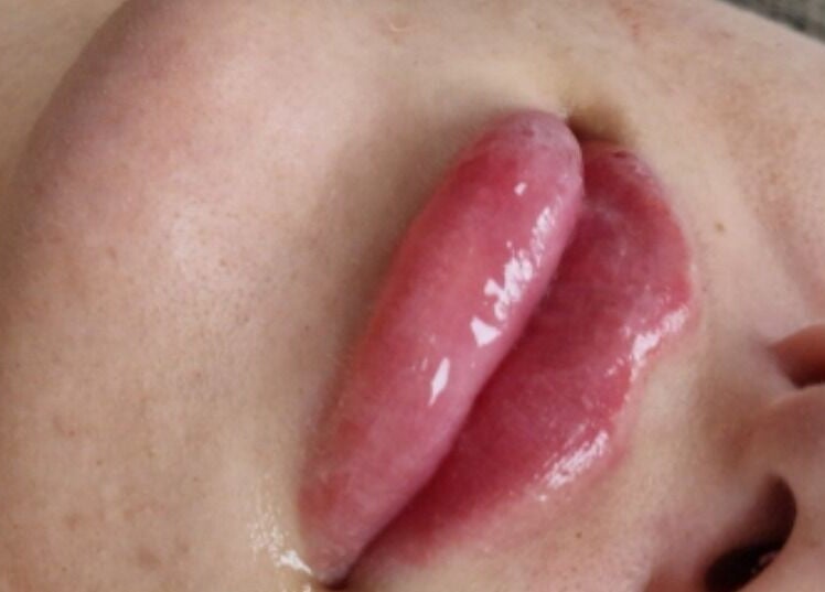 Close-up of glossy lips after a beauty treatment at By San Aesthetics in Telford, England, GB.
