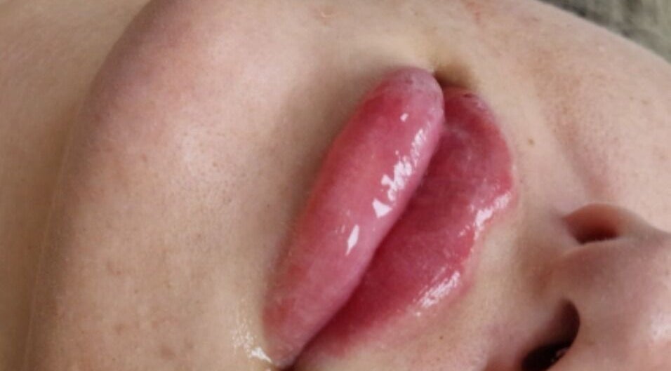 Close-up of glossy lips after a beauty treatment at By San Aesthetics in Telford, England, GB.
