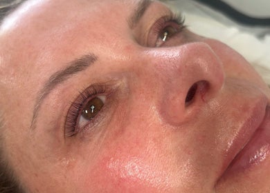 Client with radiant skin after treatment at Halo Beauty Studio, Letchworth Garden City, England, GB.