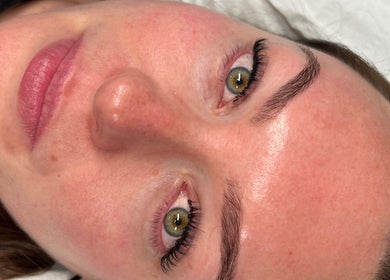 Close-up of a face with glowing skin post-treatment at Halo Beauty Hatfield, Hatfield, England, GB.