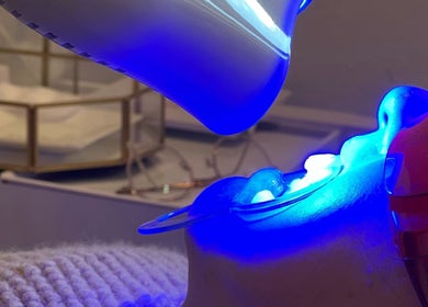 Teeth whitening treatment at LAPIS WHITENING, Singapore, SG, with blue LED light enhancing a smile.