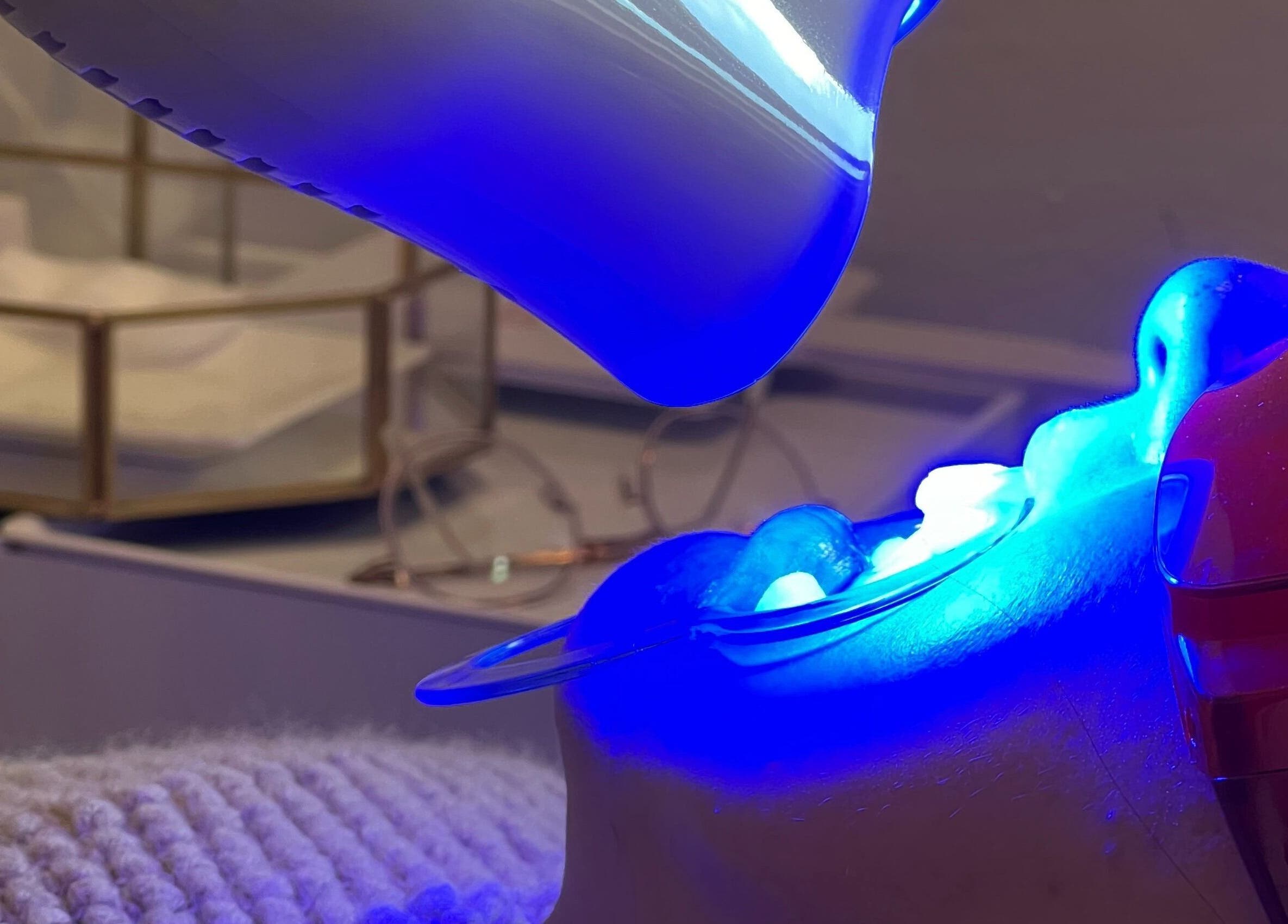 Teeth whitening treatment at LAPIS WHITENING, Singapore, SG, with blue LED light enhancing a smile.