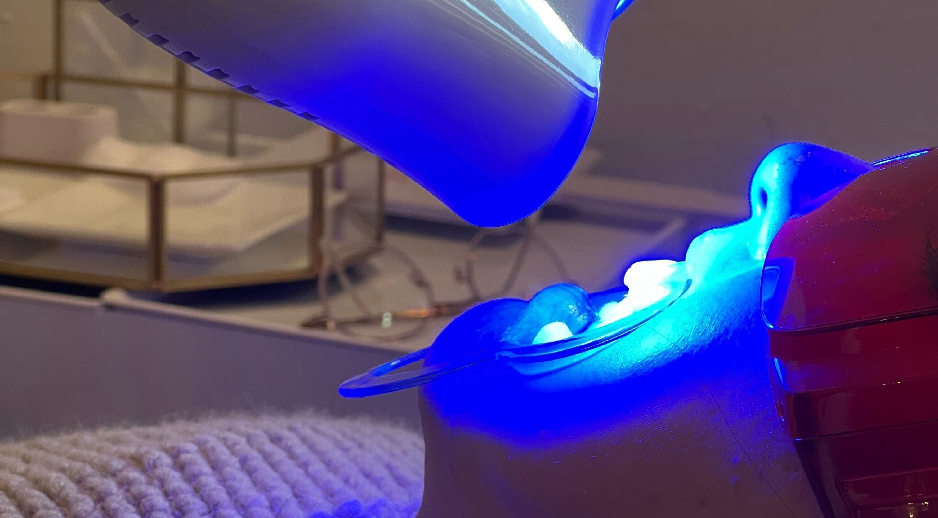 Teeth whitening treatment at LAPIS WHITENING, Singapore, SG, with blue LED light enhancing a smile.