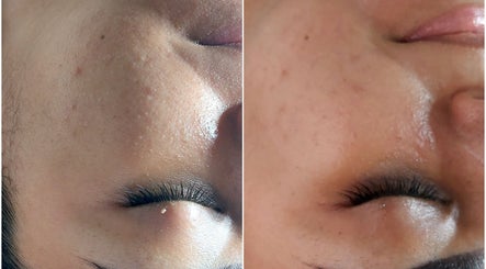 Immagine 2, SkinCare By Lizbeth