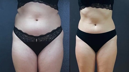 Wrap & Shape