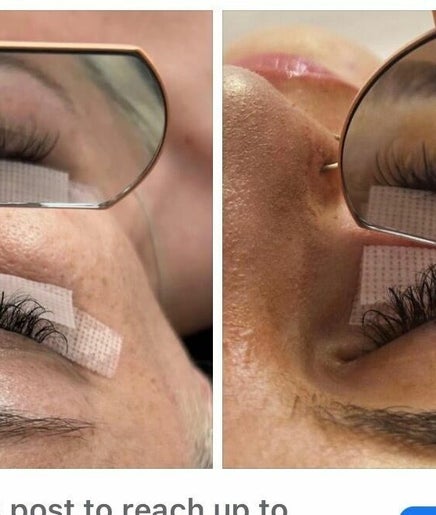 Starlash extensions image 2