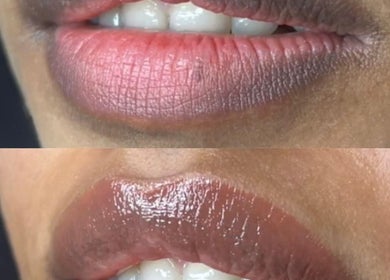 Before and after lip enhancement at KAYA Beauty Lounge in Montréal, Québec, CA, showcasing a glossy finish.