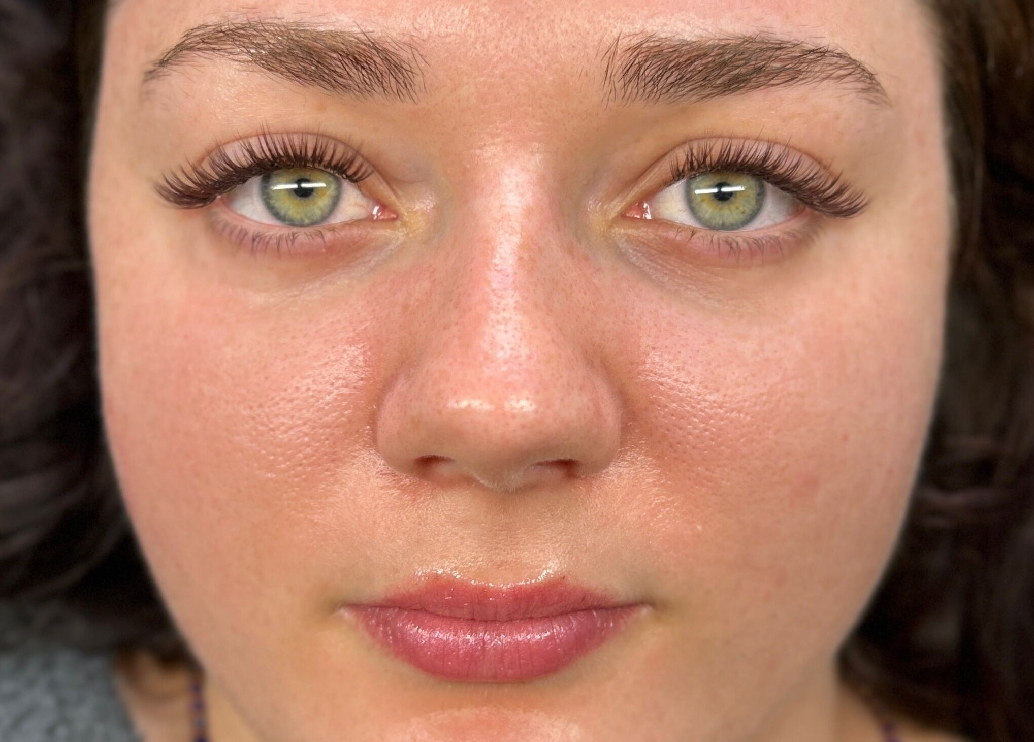 Close-up of refreshed skin and eyes post-treatment at CeLuxe Aesthetics, Southport, Queensland, AU.