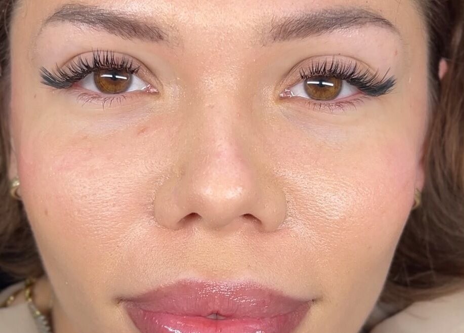 Close-up of radiant skin after treatment at CeLuxe Aesthetics, Southport, Queensland, AU.