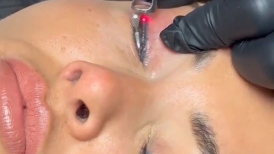 Eyebrow Eyeliner Tattoo Removal