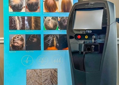 Advanced hair treatment display and machine at ELEVATE, Bellmore, New York, US spa.