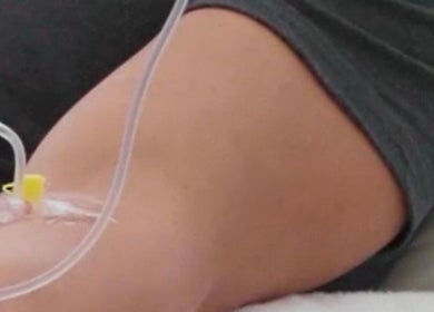 Wellness infusion treatment at ELEVATE in Bellmore, New York, US, highlighting relaxation and rejuvenation.