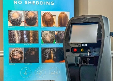 ELEVATE Bellmore, New York, US showcases hair treatment results and equipment for no-shedding solutions.