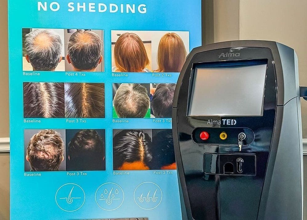 ELEVATE in Bellmore, New York features hair restoration technology with before-and-after results display.
