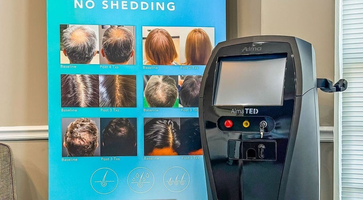 ELEVATE in Bellmore, New York features hair restoration technology with before-and-after results display.