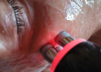 Tratamiento facial con luz en Cris Falcão Beauty PMU, Cambrils, Cataluña, ES.