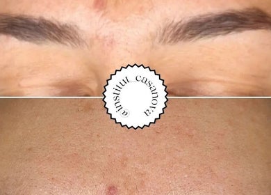 Soin du visage à l'Institut Casanova, Orry-la-ville. Résultats éclatants et peau lisse et nette.