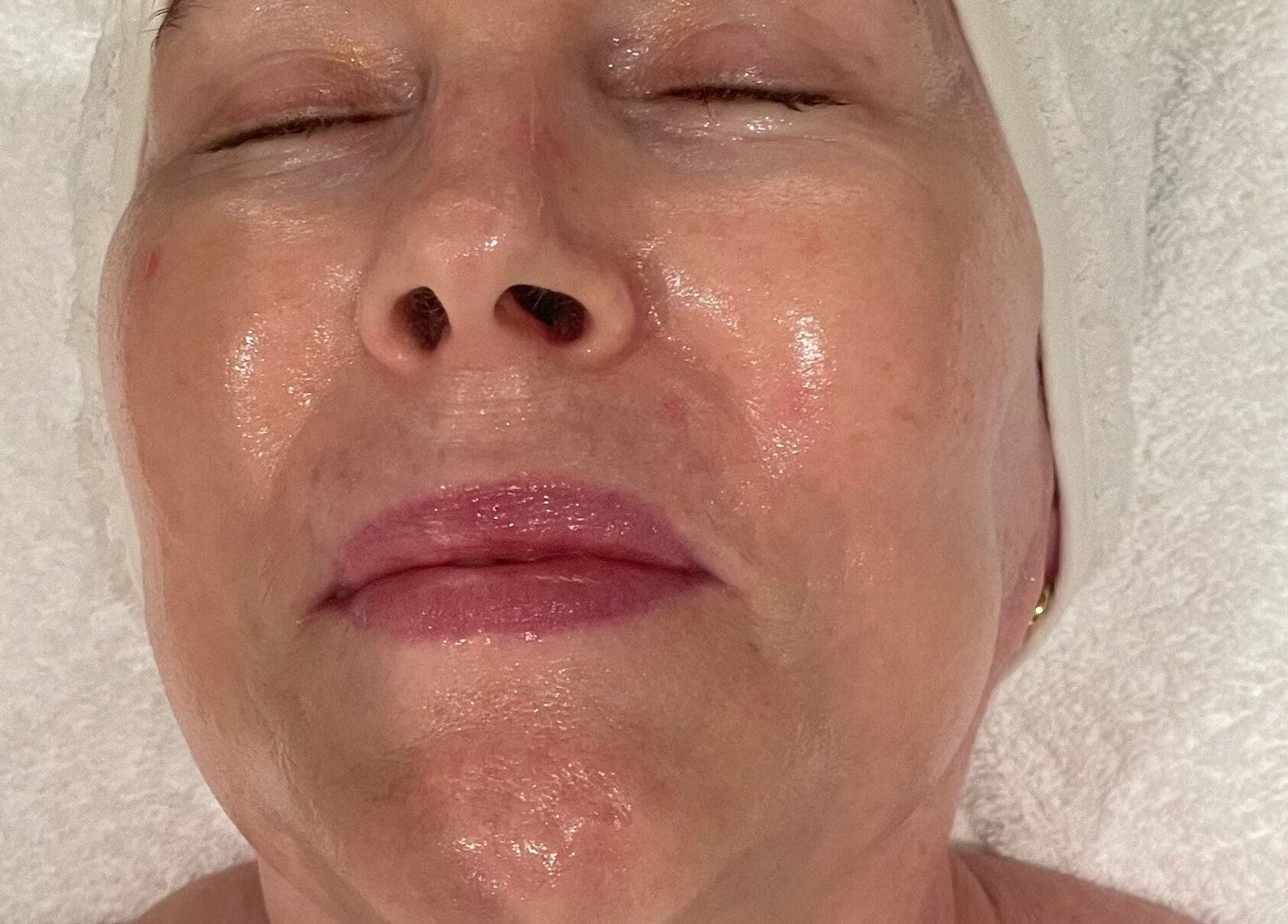 Facial treatment at LOVESTETIC in Abingdon, England, GB, showcasing glowing skin and relaxation.