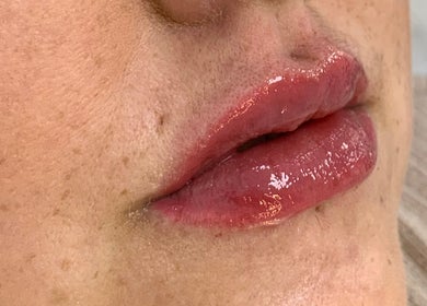 Closeup of glossy pink lips from Absolute Skin & Aesthetics Fareham, located in Fareham, England, GB.