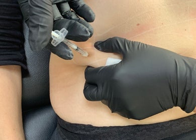 Close-up of a treatment at Absolute Skin & Aesthetics Fareham, located in Fareham, England, GB.