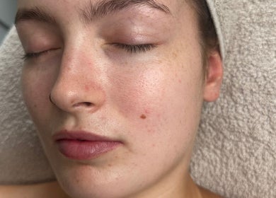 Relaxed face during skincare at Absolute Skin & Aesthetics Fareham, Fareham, England, GB.