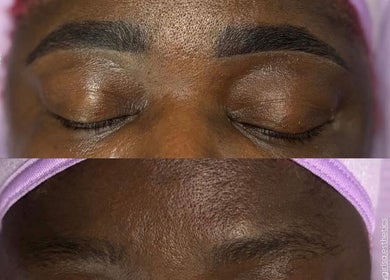 Microblading results before and after at Pretty Girls Aesthetics, Buffalo, NY, US.