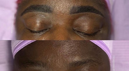 Microblading results before and after at Pretty Girls Aesthetics, Buffalo, NY, US.