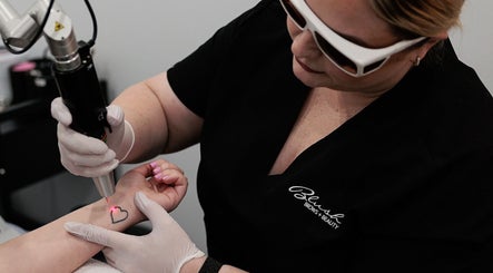 Laser Tattoo Removal Mackay